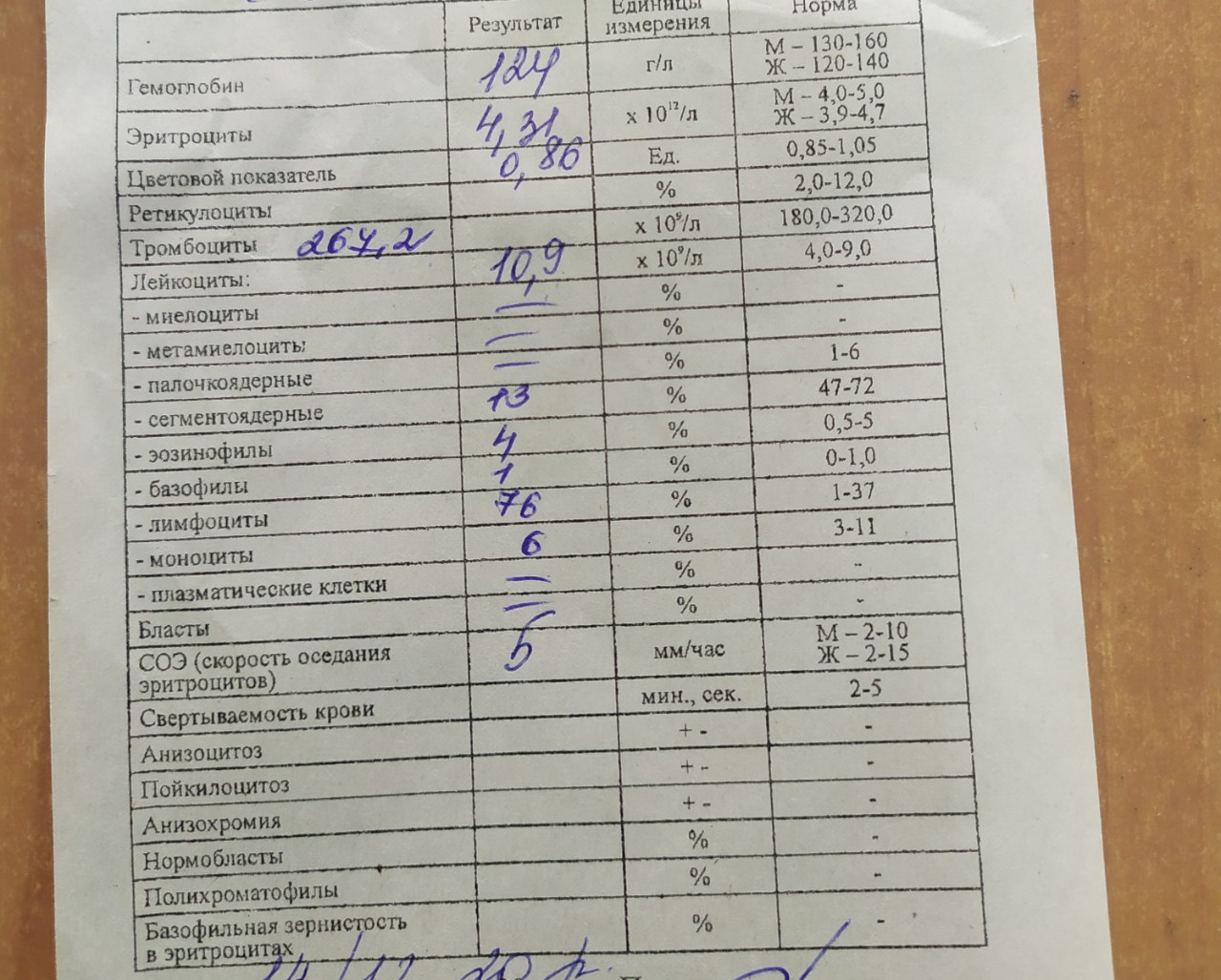 Бактерии у ребенка в моче: что это значит и когда следует бить тревогу?