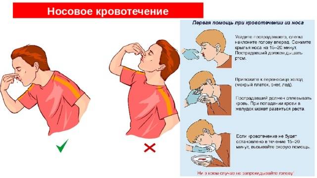 Кровь из носа у ребенка причины (4, 5, 6, 7, 8 лет): почему часто течёт ночью - лечение