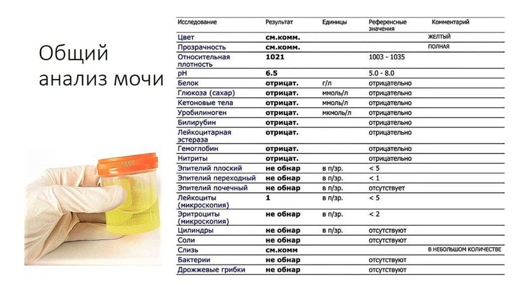 Лейкоциты в моче у новорожденного