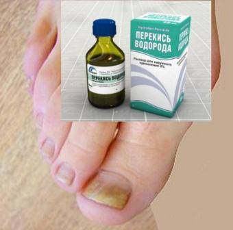 Грибок ногтя и лактация