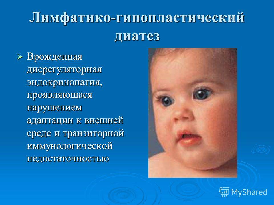 Диатез на щеках у ребенка: лечение, советы комаровского