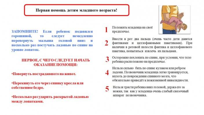 Что делать если ребенок подавился: руководство к действию