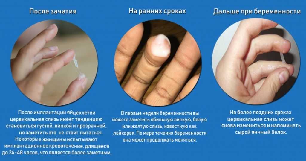 Скудные месячные при беременности