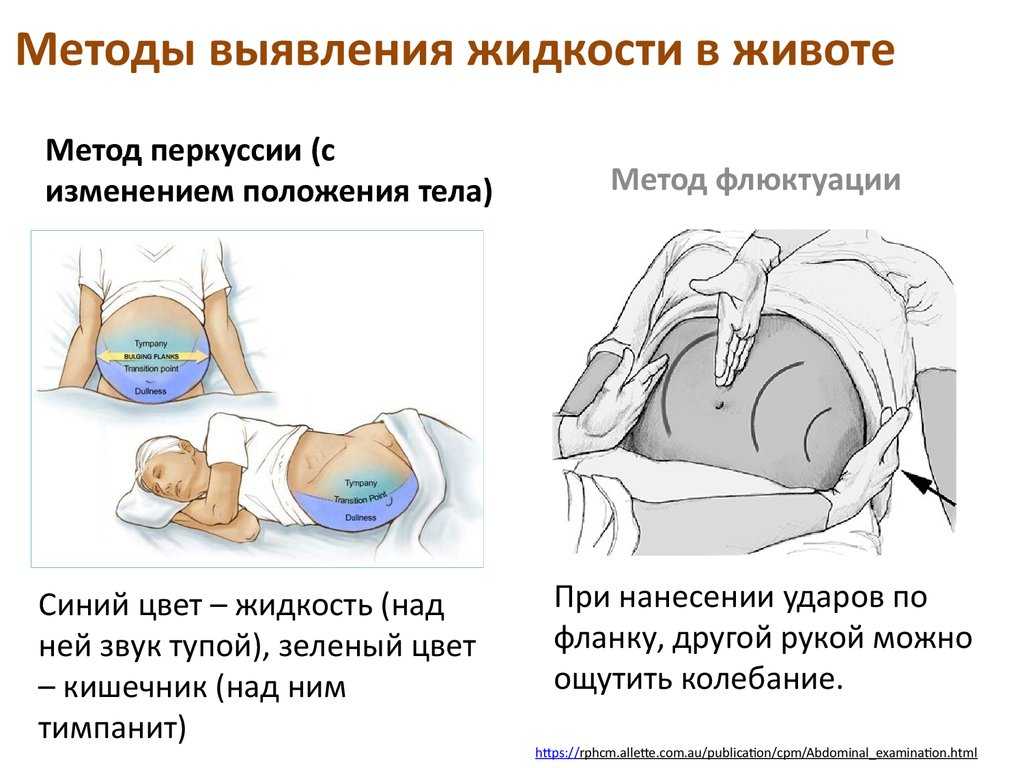 Ребенок икает в животе — как определить и что делать