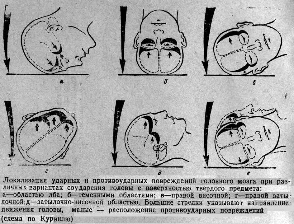 Ребенок ударился головой - на что обратить внимание, что делать