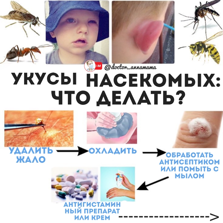 Дирофиляриоз