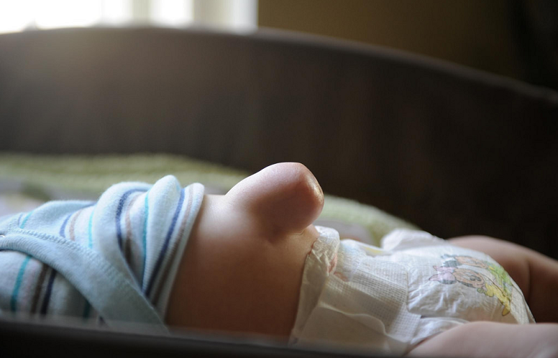 Пупочная грыжа у новорожденных детей: лечение младенцев, признаки у ребенка, фото
