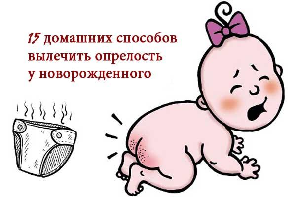 Все об опрелостях у новорожденных малышей: причины появления, эффективные методы профилактики и лечения
