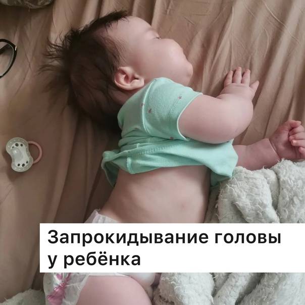 Грудной ребенок запрокидывает голову назад: причины
