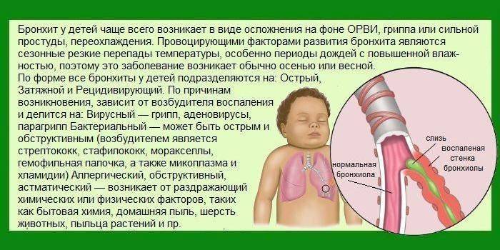 Что нужно знать родителям о симптомах и лечении трахеита у ребёнка?