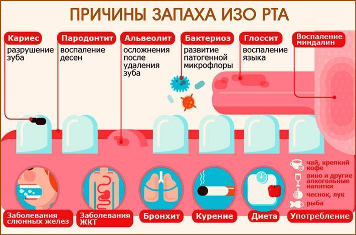 Воняет изо рта что делать. Неприятный запах изо рта у ребенка. У ребенка пахнет изо рта причины. У ребёнка запах изо рта причины.