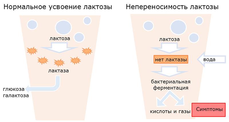 Анализ на лактозную недостаточность у грудничка как сдавать
