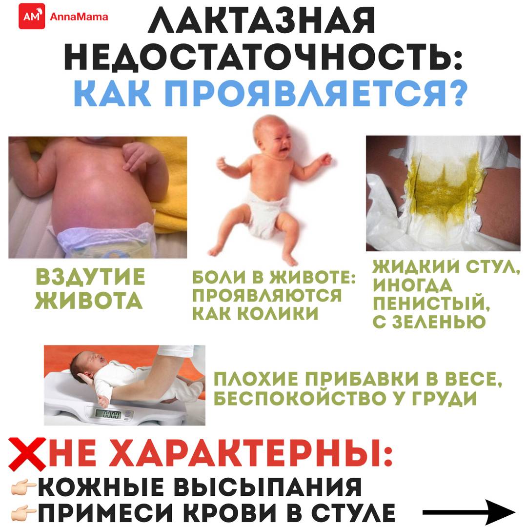 Непереносимость лактозы у грудничков — симптомы и признаки