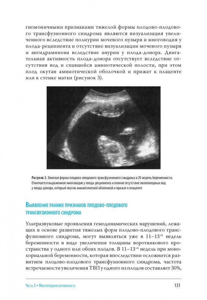 Зеленые околоплодные воды