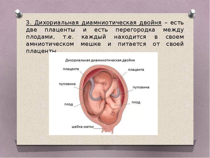 Многоплодная беременность - первые признаки на ранних сроках