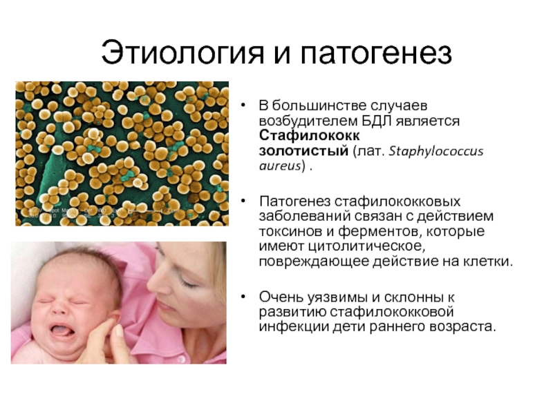 Стафилококк в носу у ребенка и горле: как лечить золотистую инфекцию, симптомы, причины
