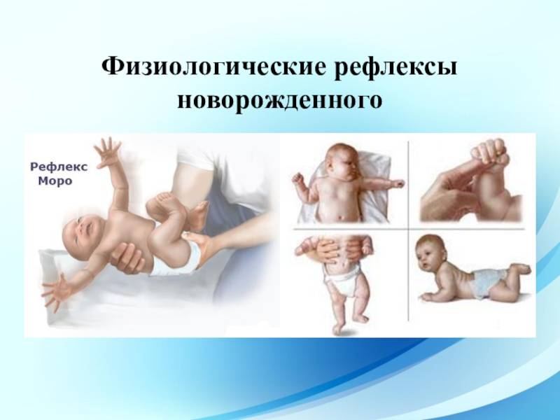 Рефлексы новорожденного