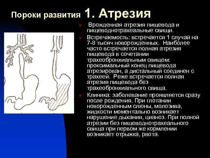 Атрезия пищевода у новорожденных