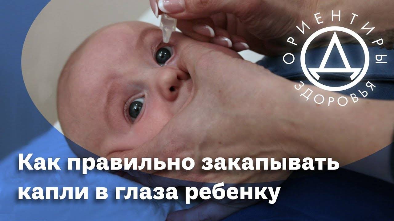 Как правильно закапывать капли в глаза ребенку