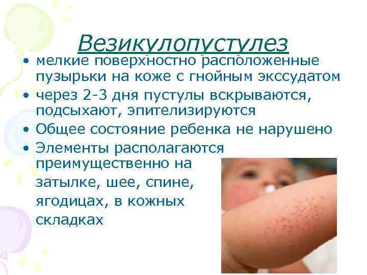 Сыпь на спине у ребенка – виды, причины появления и методы лечения. сыпь на спине у ребенка — откуда берутся красные прыщи