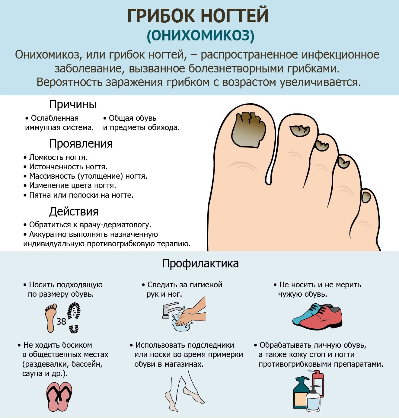 Вросший ноготь у младенца комаровский
