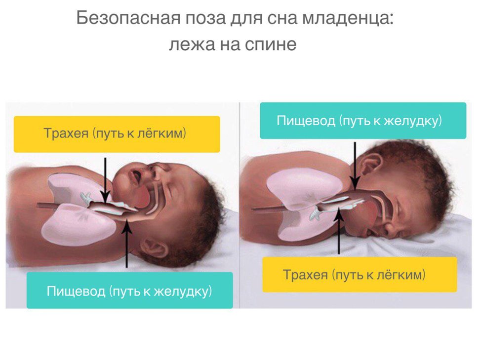 Почему новорожденному нельзя спать. Положение для сна новорожденных. Правильное положение для сна новорожденного. Положение сна грудничка. Нормальное положение новорожденного во сне.