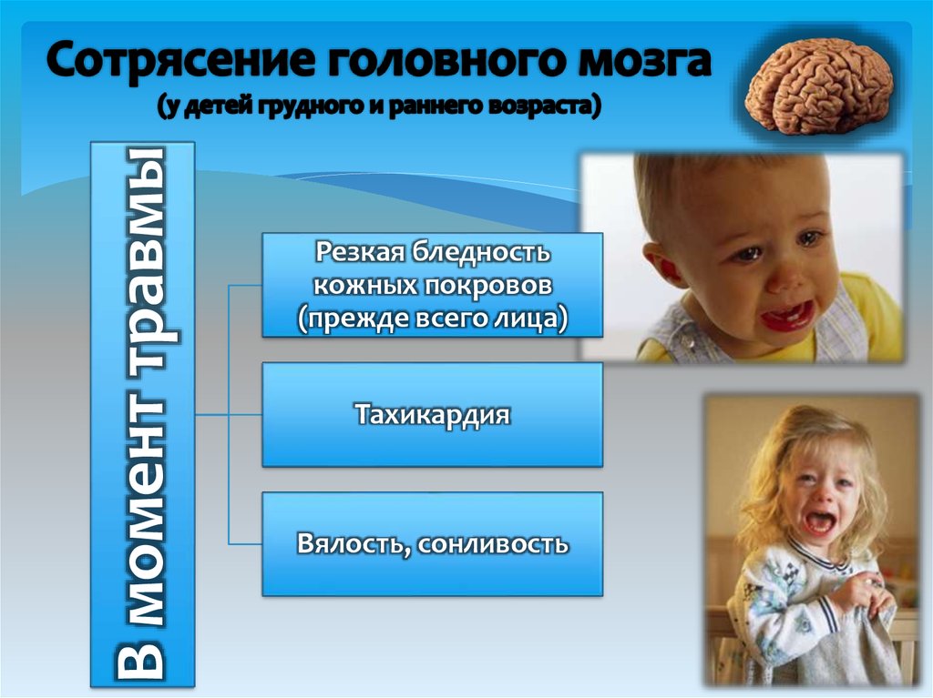 Признаки сотрясения мозга: описание симптомов, как определить по ребенку до 1 года