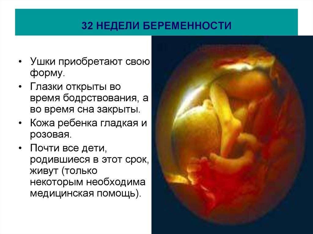 32 неделя беременности - живот, шевеления, развитие плода, фото, узи на 32 неделе | doctorfm.ru