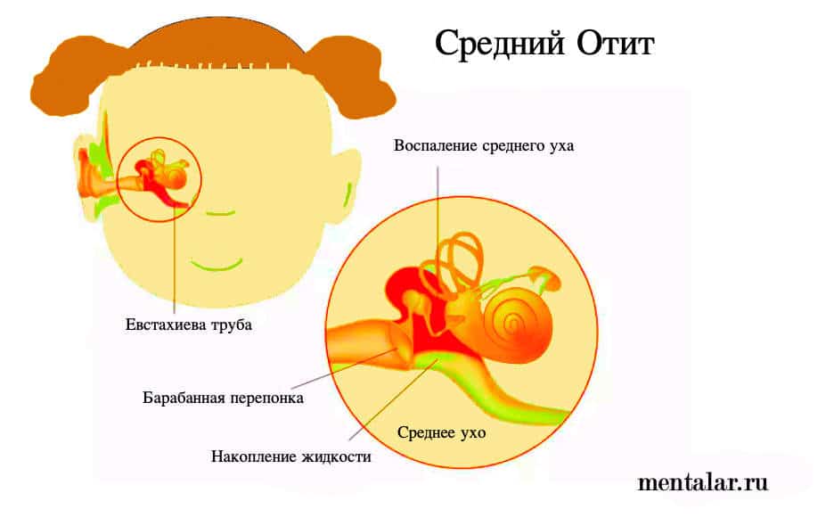 Как понять, что у грудничка болит ухо: симптомы и лечение | terra-baby.ru