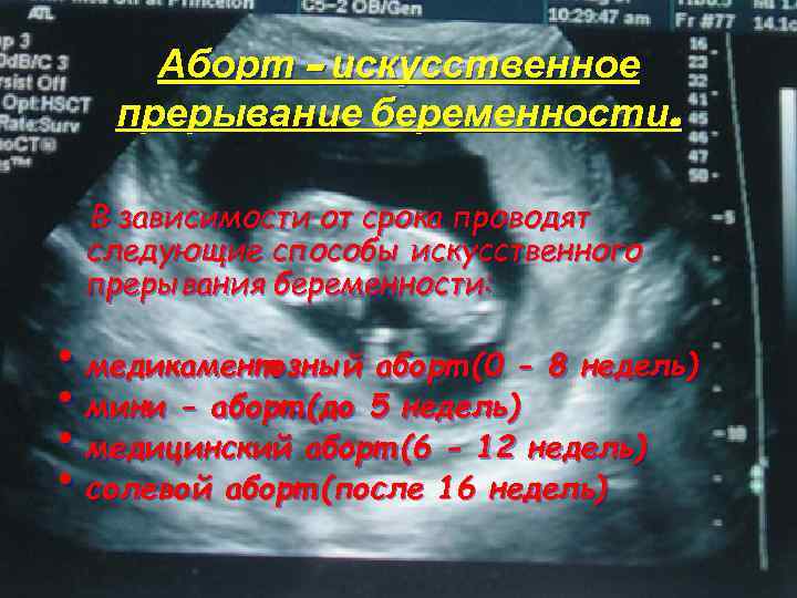 Как пережить выкидыш на раннем и позднем сроке – советы психолога