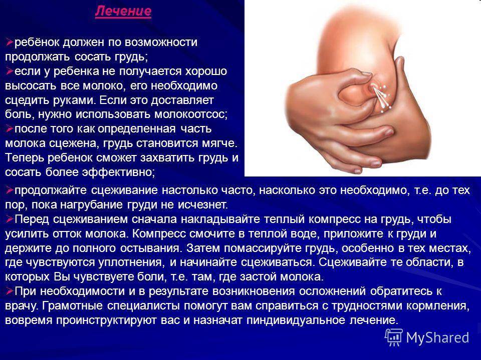 Лактостаз у кормящей матери: симптомы и признаки, как лечить, профилактика