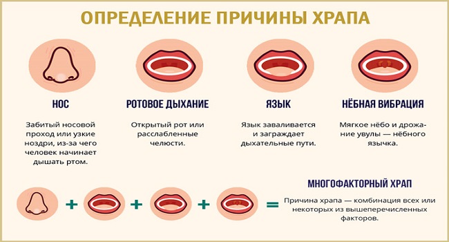 Заложенность носа у грудничка во время сна