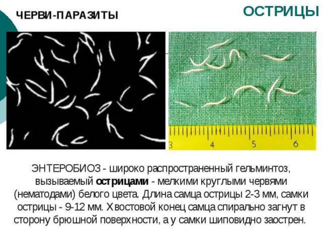 Острицы у ребенка или у взрослого, руководство | разумный потребитель медицинских услуг
