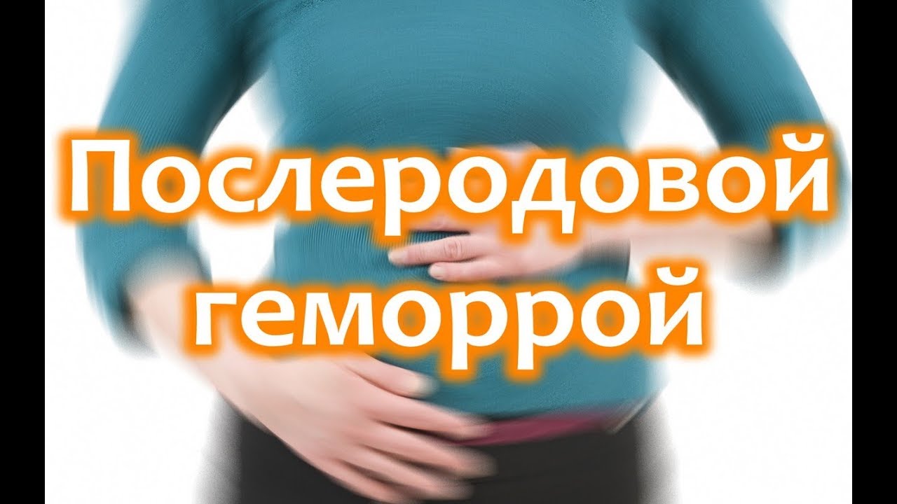 Проблема геморроя после родов: признаки болезни, свечи и другие рекомендации по лечению при грудном вскармливании