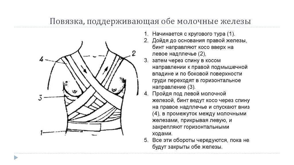 Завершение лактации перетягиванием грудного молока