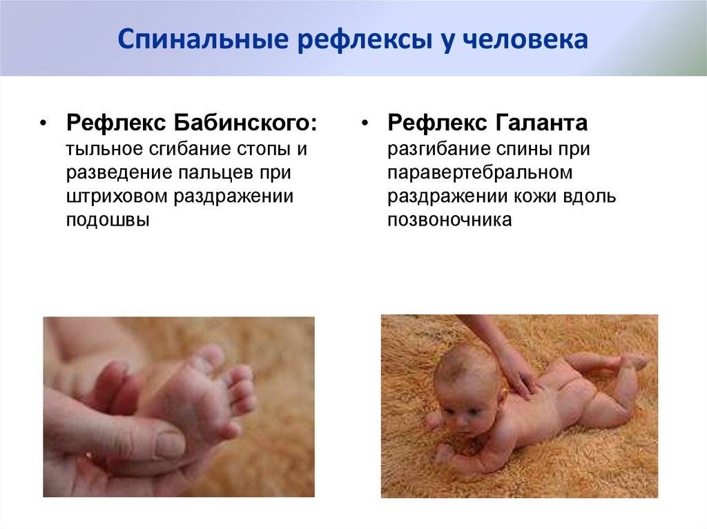 Все о безусловных рефлексах новорожденного: двигательные, бабинского, галанта