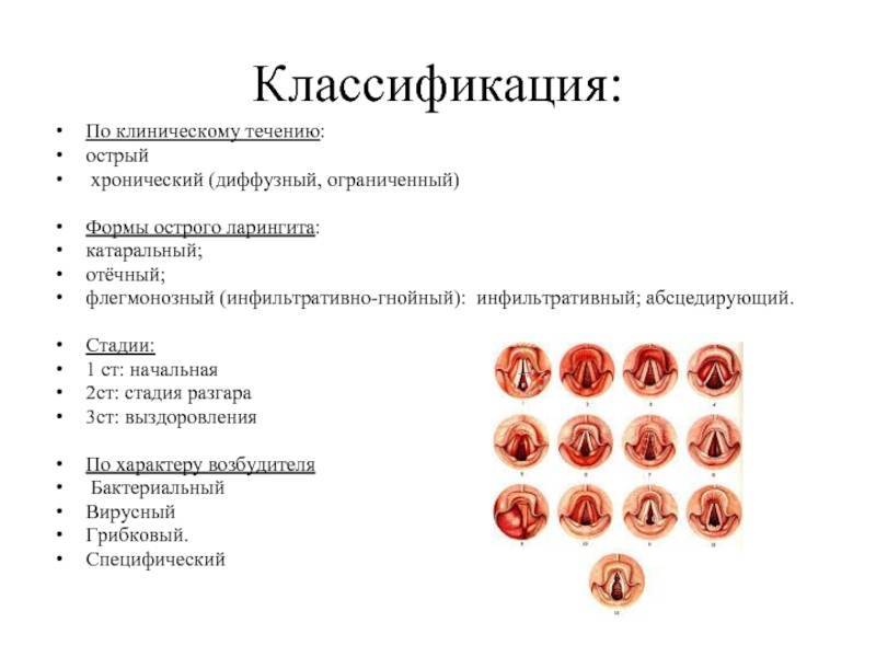Лечение аденоидов