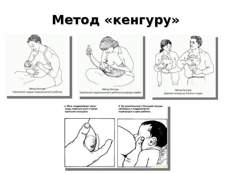 Как устроена система помощи недоношенным в германии | правмир
