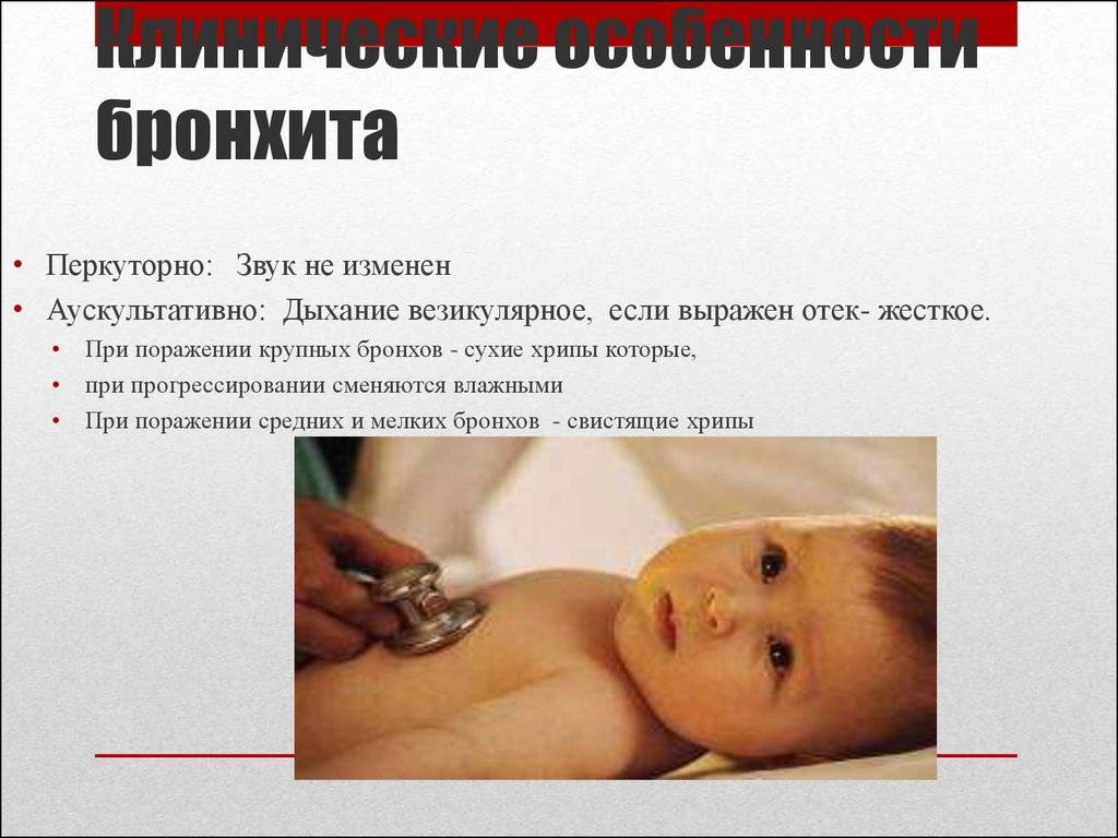 У ребенка хриплый голос и кашель либо у малыша есть хрипы в горле, но он не кашляет: что делать?