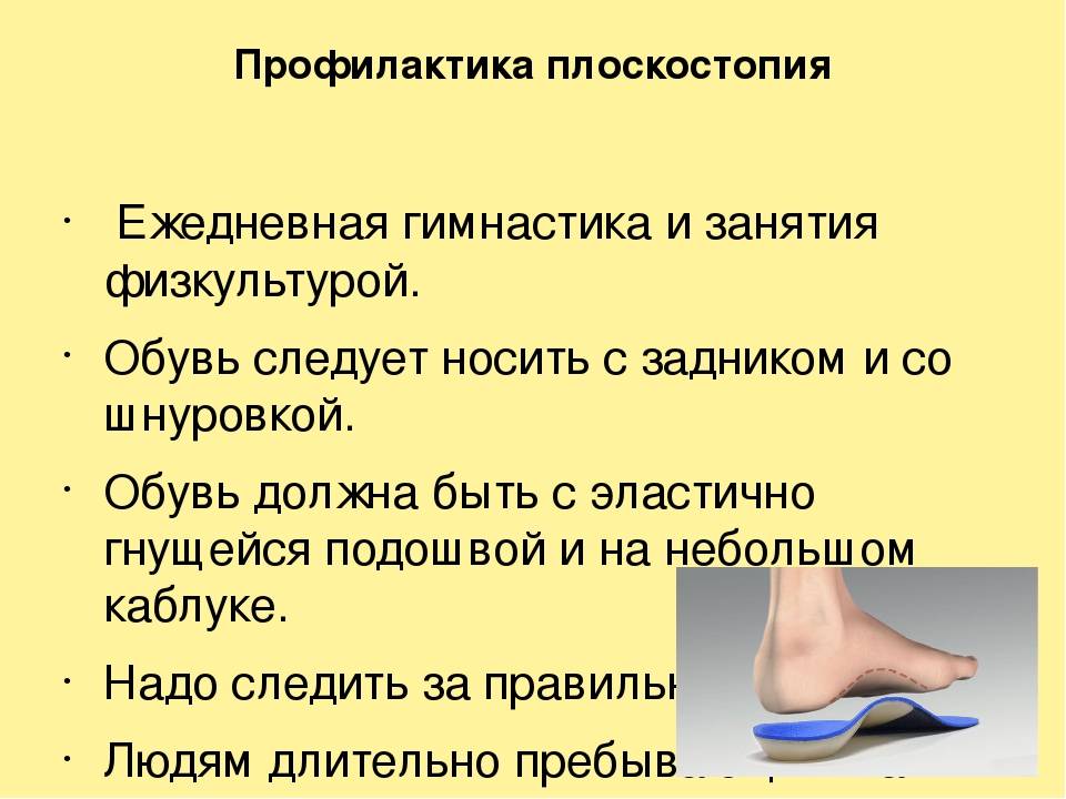 Плоскостопие у подростков и особенности его лечения