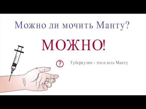 На какой день проверяют манту у ребенка