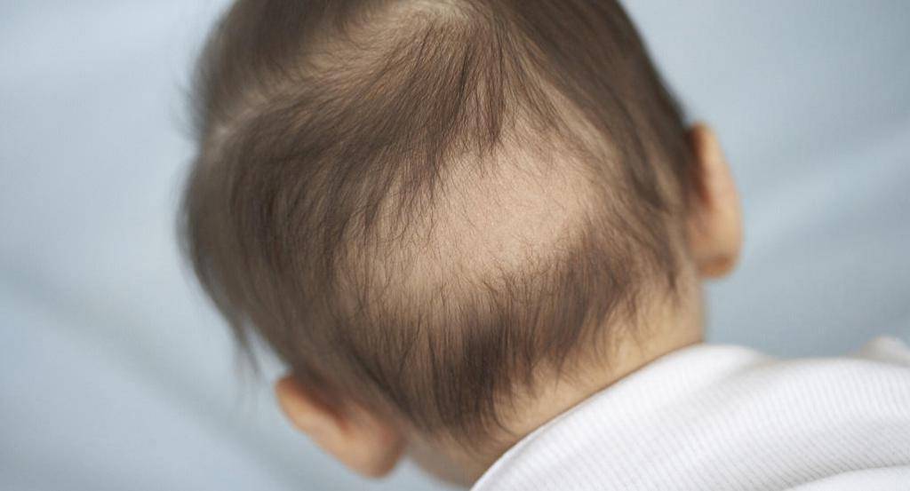 Волосы у ребенка на затылке не растут, стираются - что делать и как решить проблему, к какому врачу обращаться и можно ли справиться самостоятельно в домашних условиях
