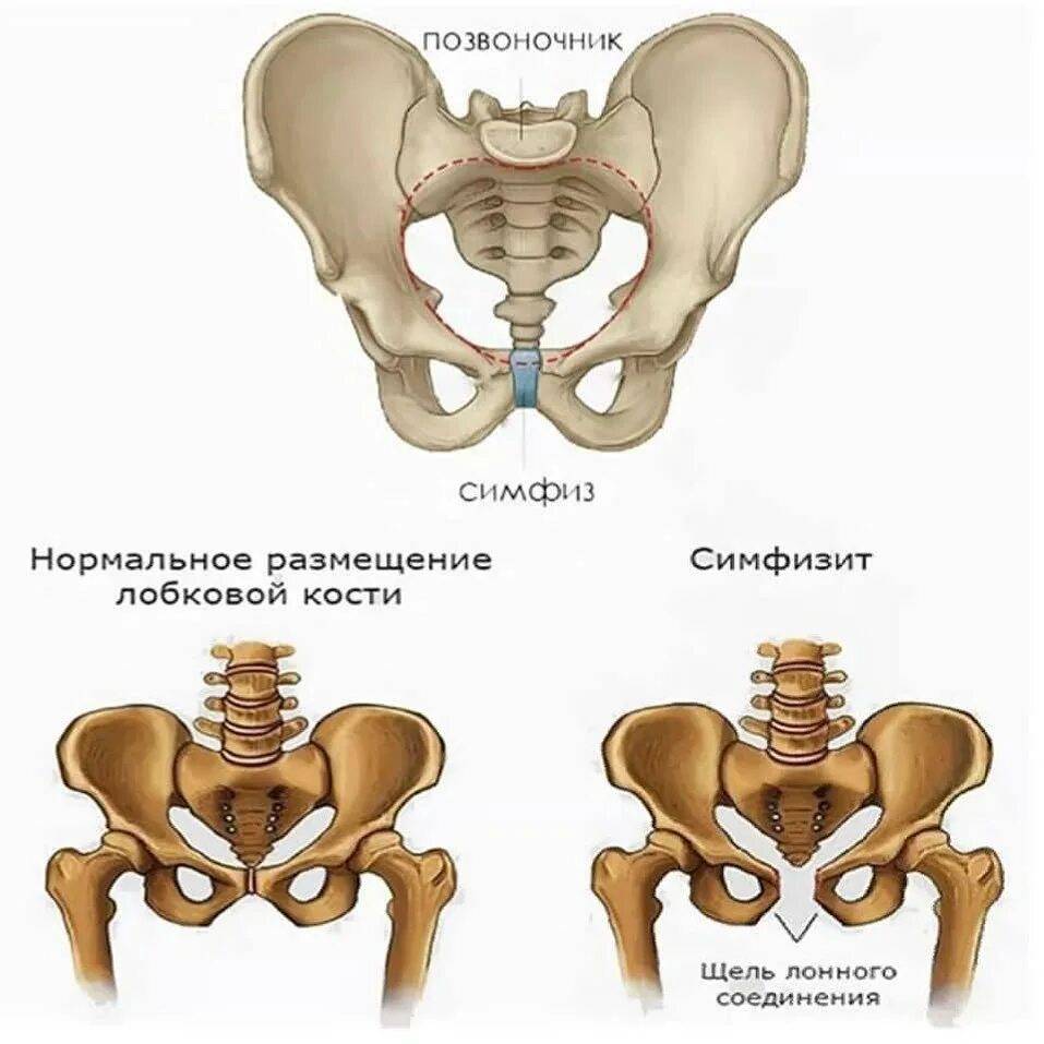 Причина боли лобковой кости