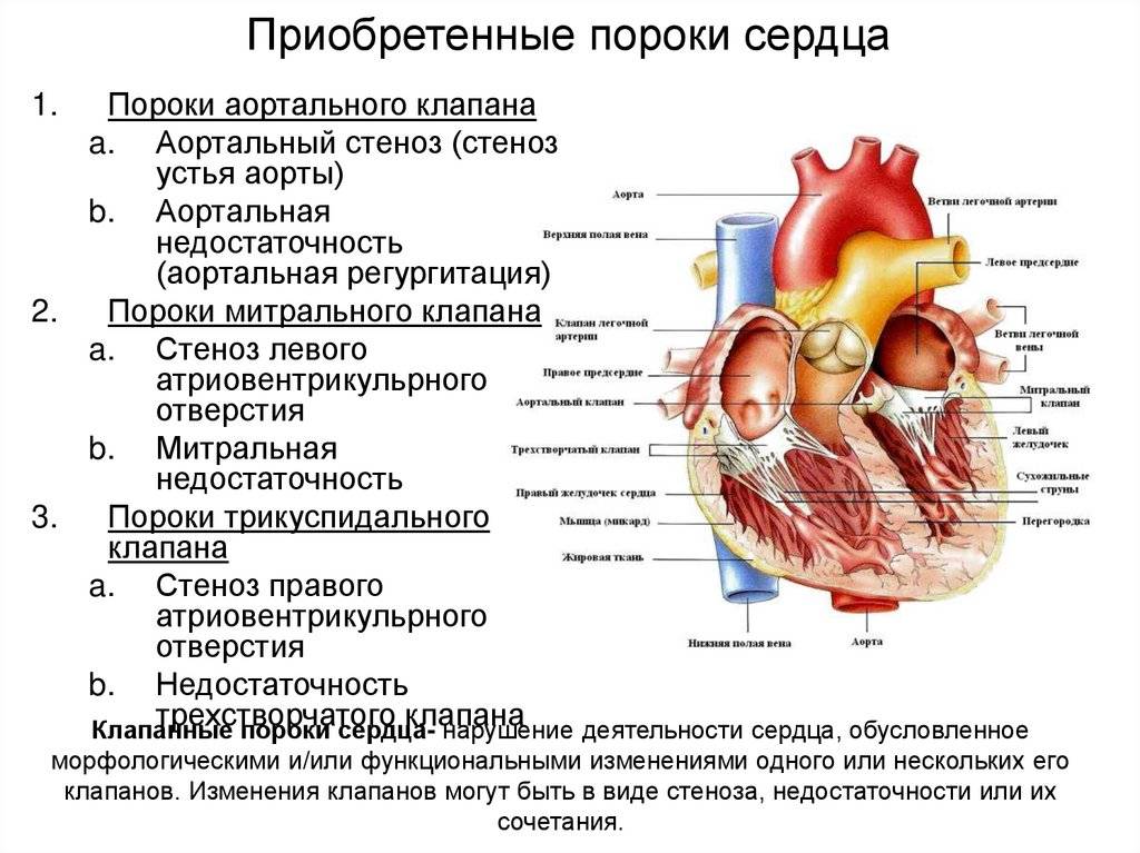 Врожденный порок сердца у новорожденных: симптомы, лечение