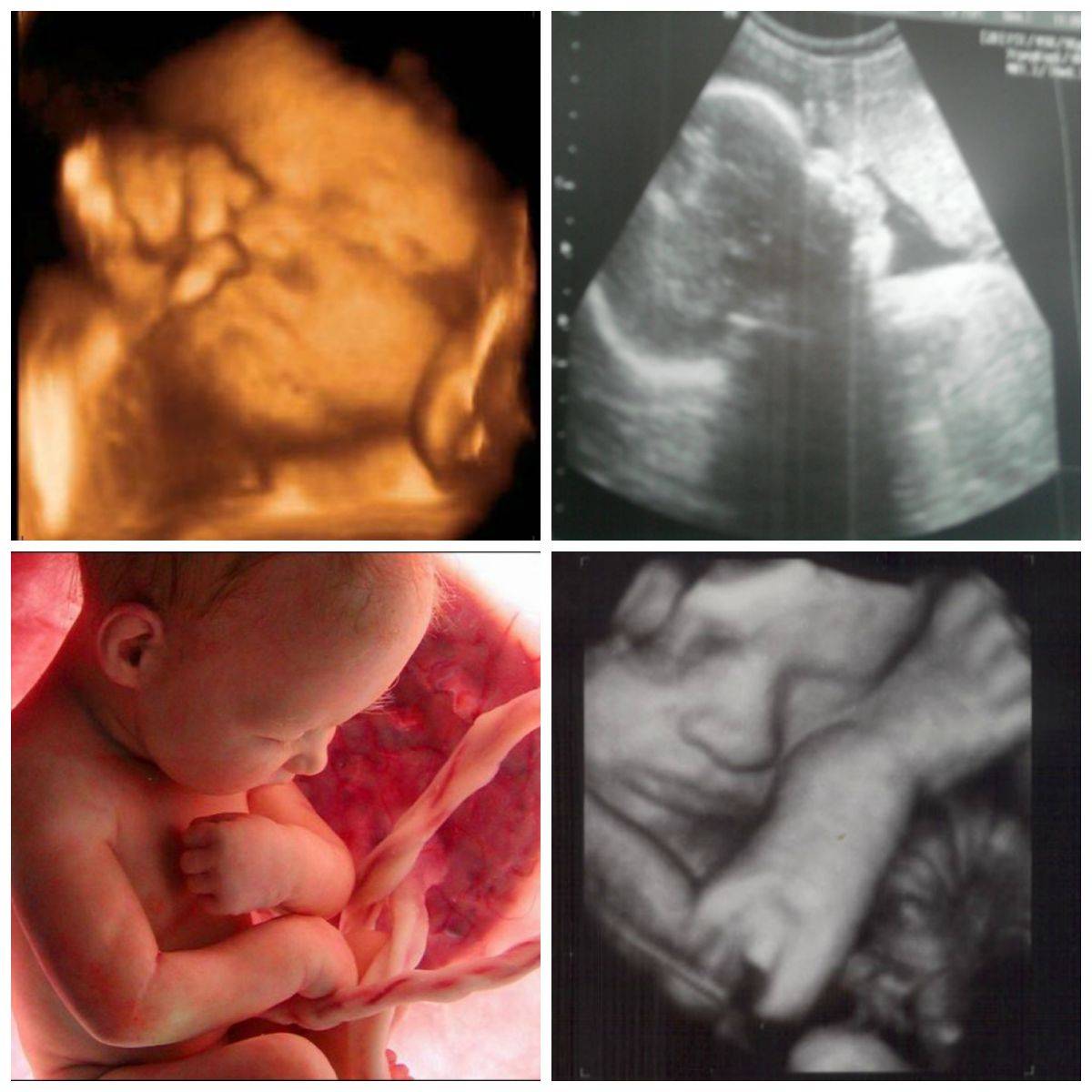 32 неделя беременности: развитие плода, ощущения и анализы