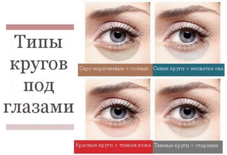 Синяки под глазами у грудничка: причины и лечение