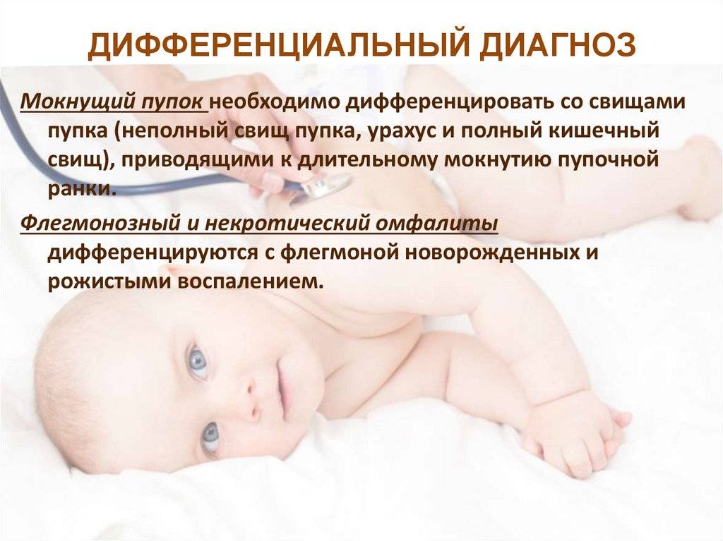 Советы по лечению мокнущего пупка у новорожденного