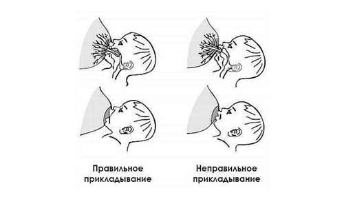 Лактостаз: как помочь? - статьи - клиника «c нуля» (здоровая семья)