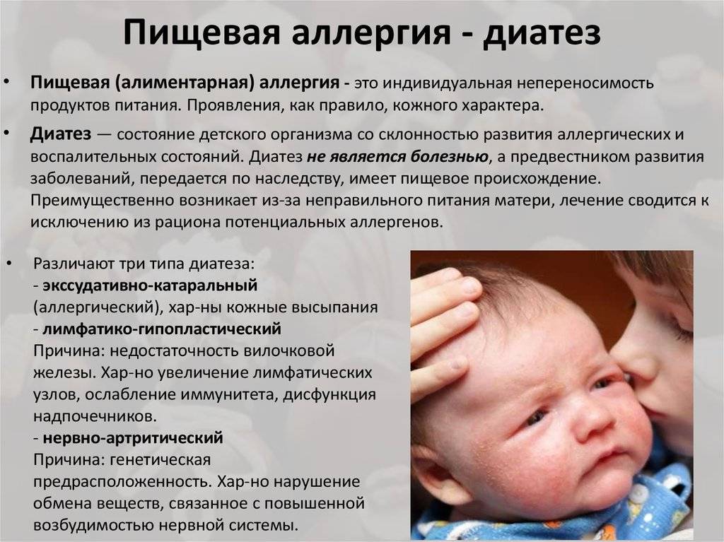 Как отличить потницу от аллергии у новорожденного: симптомы, причины сыпи и дерматита, лечение грудничка