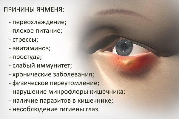 Ячмень на веке глаза: причины появления, лечение, вскрытие ячменя.